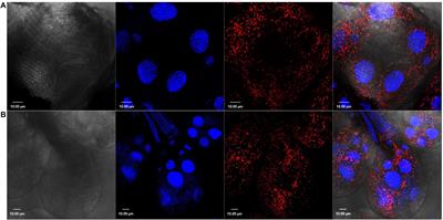 Rickettsia parkeri infection modulates the sialome and ovariome of the Gulf coast tick, Amblyomma maculatum